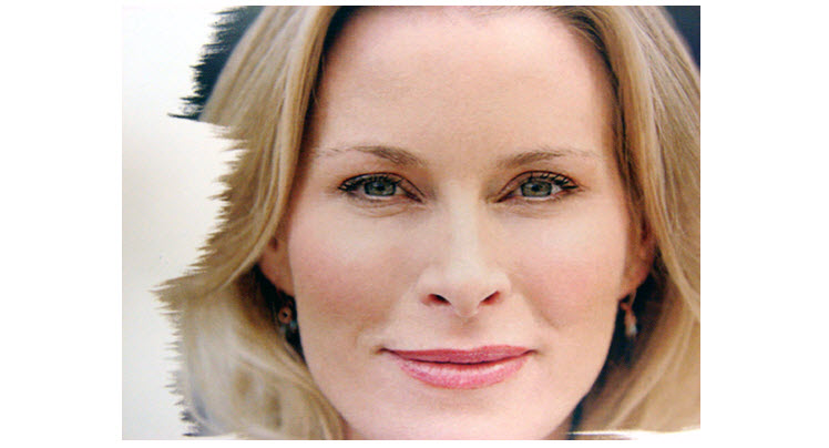 Botox Montreal Botox Montreal